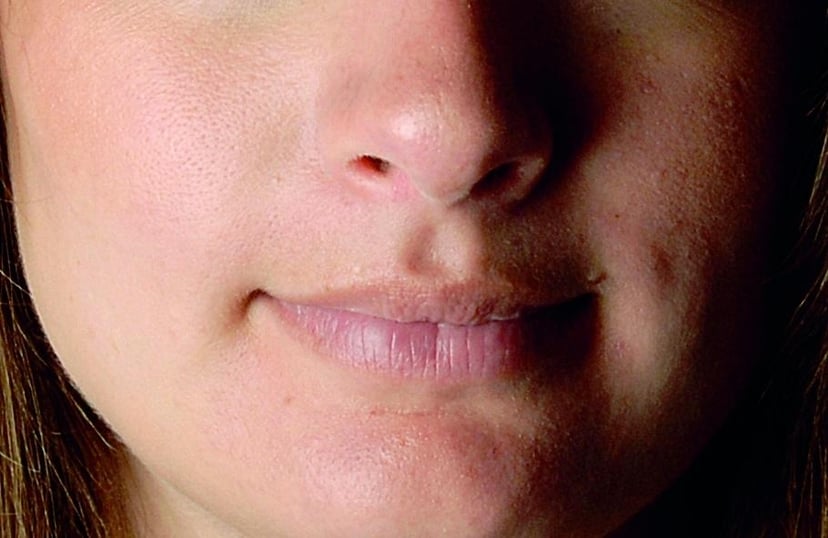 Jak poradzić sobie z niedoskonałościami skóry na portretach