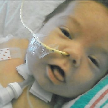 Lekarze uratowali noworodka dzięki drukarce 3D