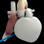 Pierwsze wszczepione na stałe sztuczne serce bije już w ludzkiej piersi