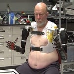 Rewolucja w protetyce: proteza sterowana myślami