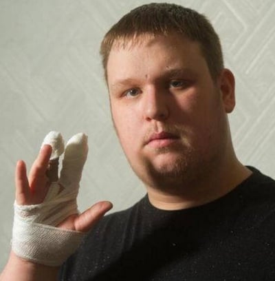 Xperia T3 wybuchła mu w dłoni