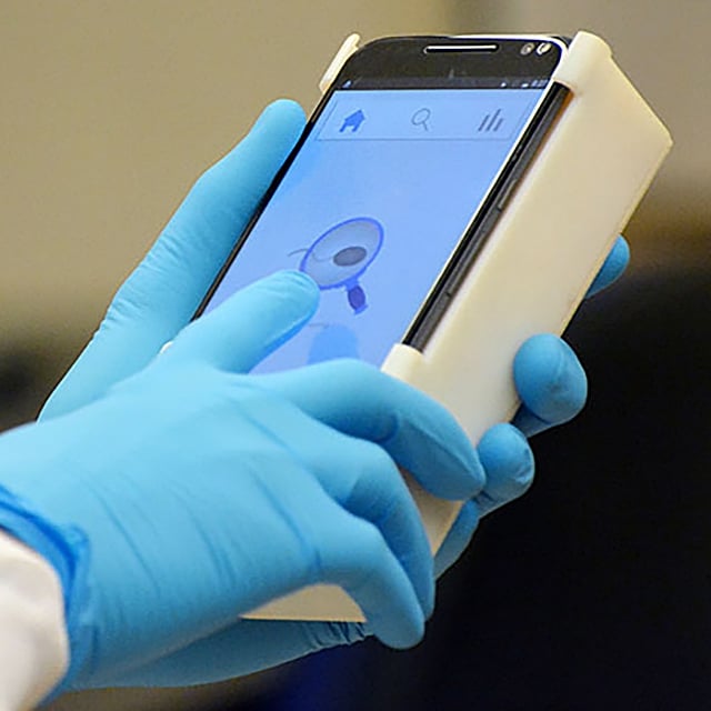 Tani test na męską płodność… z wykorzystaniem smartfona