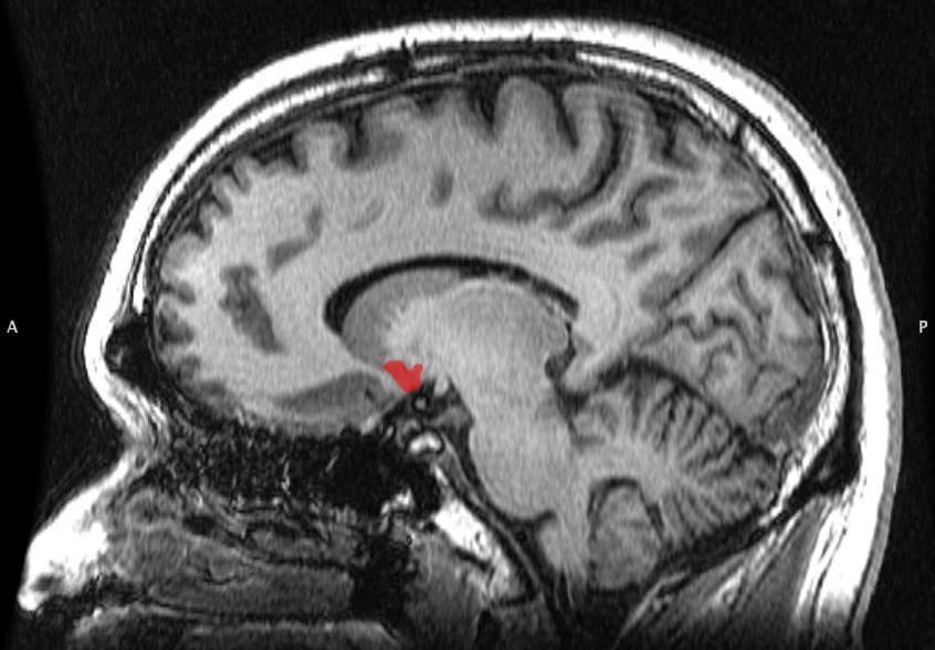 Użytkownicy Facebooka mają mniej szarych komórek