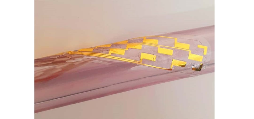 Miniaturowy implant może położyć kres uciążliwym bólom