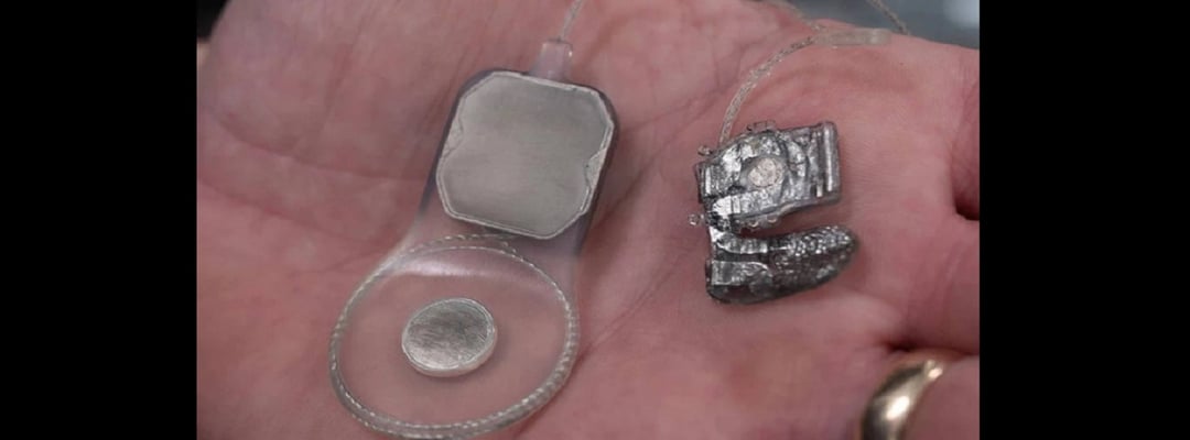 Bioniczne oko przywraca wzrok. Czas na próby na ludziach