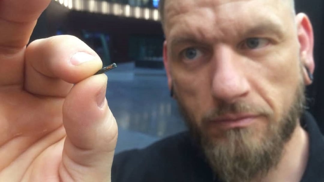 Powstał mikrochip umieszczany pod skórą. Może zawierać informacje medyczne i umożliwiać szybkie płatności