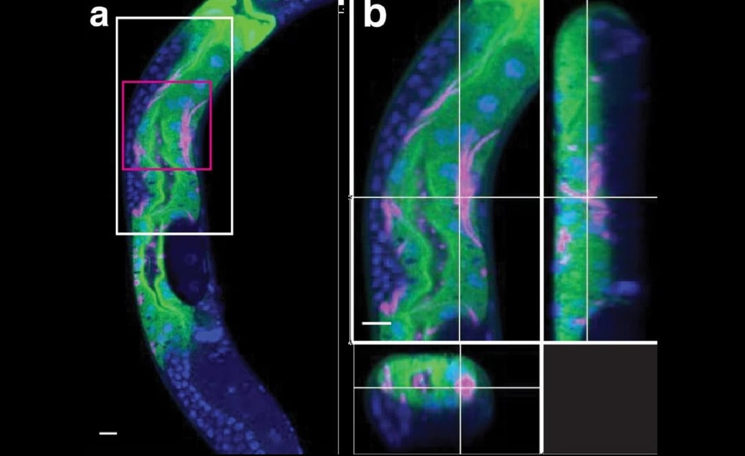 Bakterie zakażają w nieznany wcześniej sposób. Naukowcom udało się to zaobserwować
