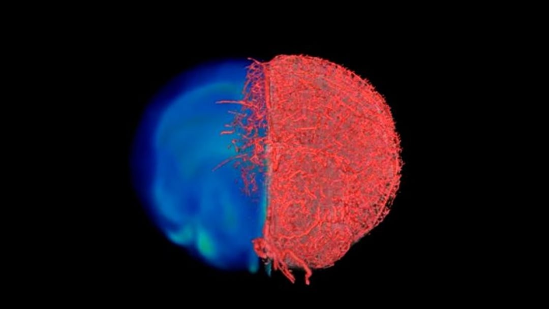 Jak zobaczyć niewidzialne? VascuViz to nowa technika obrazowania naczyń krwionośnych