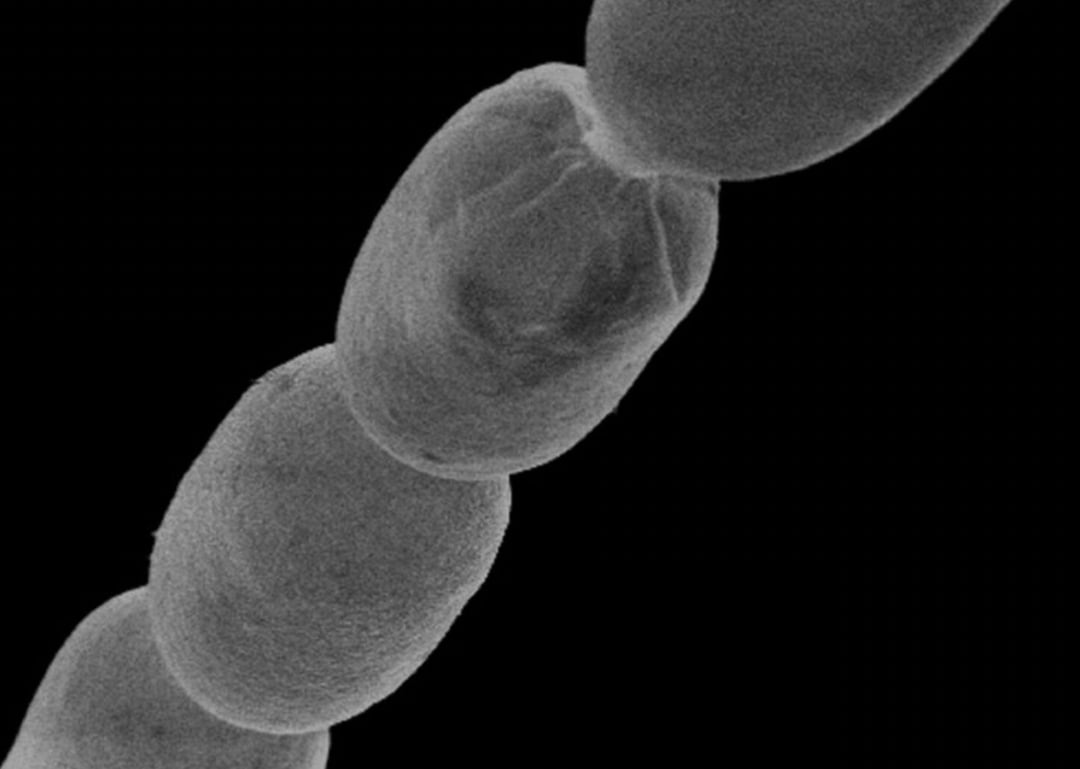 Prawdziwy gigant! Ta bakteria jest widoczna gołym okiem