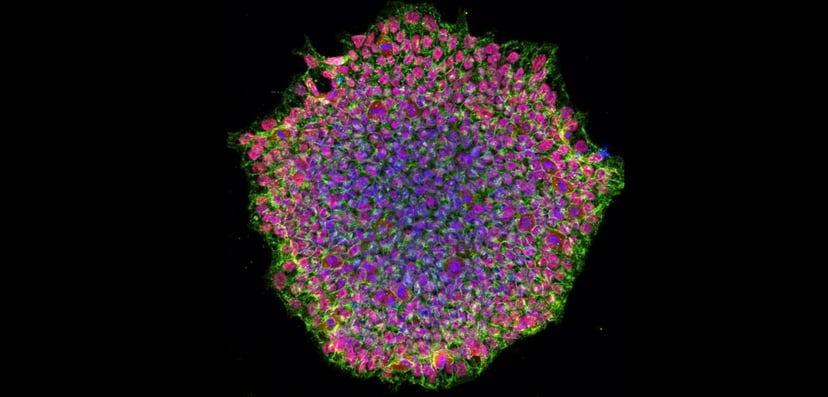 Jedna osoba, a komórki męskie i żeńskie. Niezwykły wyczyn naukowców
