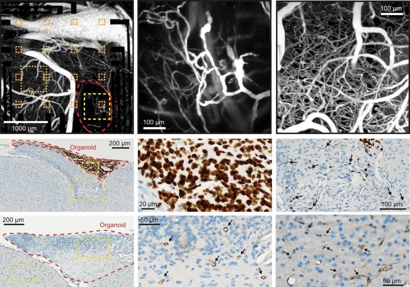 Stworzyli w laboratorium mózgi. Te zadziwiają swoją złożonością