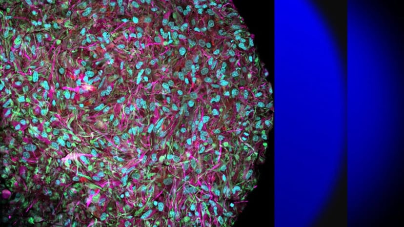 Komputery wykorzystają komórki występujące w ludzkim mózgu. Przyszłość wygląda fascynująco i przerażająco jednocześnie