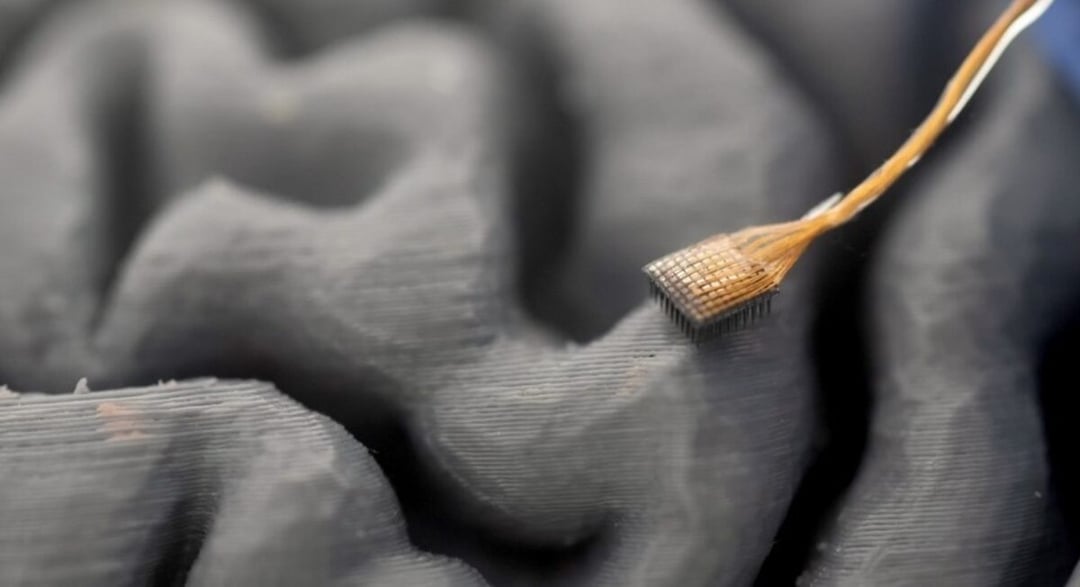 Technologia czyta myśli z dokładnością do 0,025 sekundy. Nowy implant przebija rozwiązanie Muska