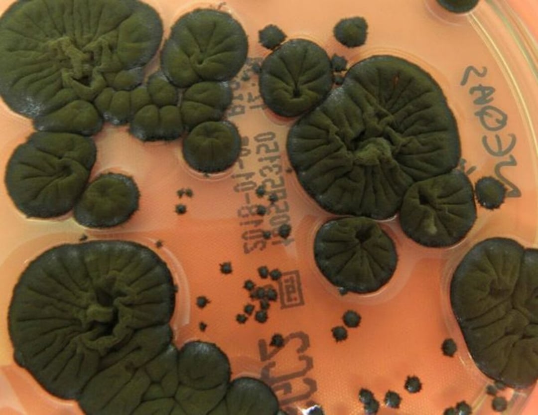 Natura znalazła sposób na promieniowanie w Czarnobylu. Ten organizm zachowuje się wbrew wszelkim zasadom biologii