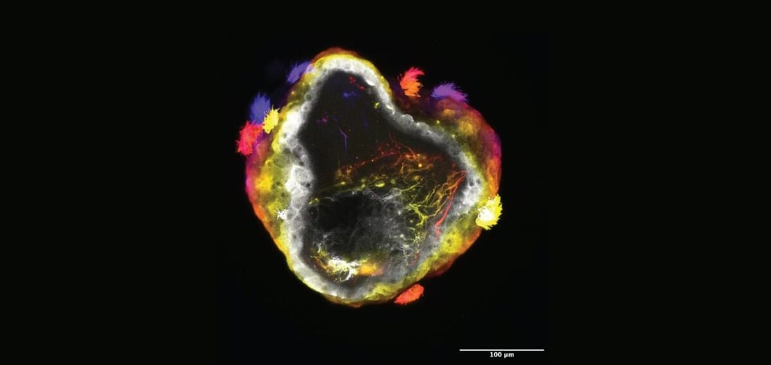 Kiedy biologia spotyka robotykę, a maszyny zaczynają „myśleć”