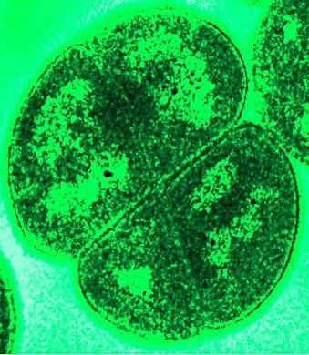 Bakterie z wbudowanym kompasem. Po raz pierwszy zmierzono ich magnetyczne właściwości