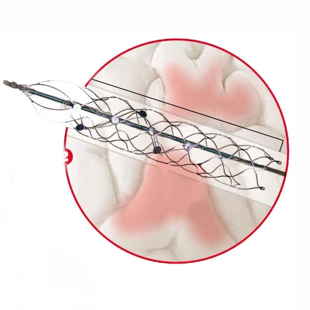 Bioniczny kręgosłup: testy na ludziach startują w 2017