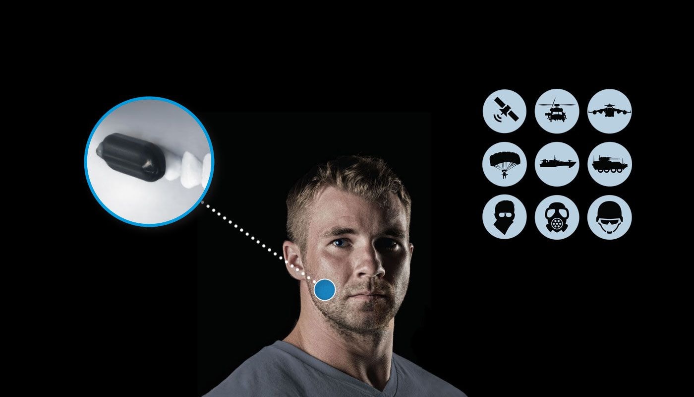 Molar Mic – niewidzialny mikrofon nakładany na zęby