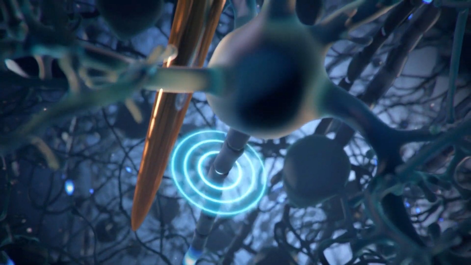 Neuralink zamierza umieszczać elektrody w bezpośrednim sąsiedztwie neuronów w mózgu (graf. Neuralink)
