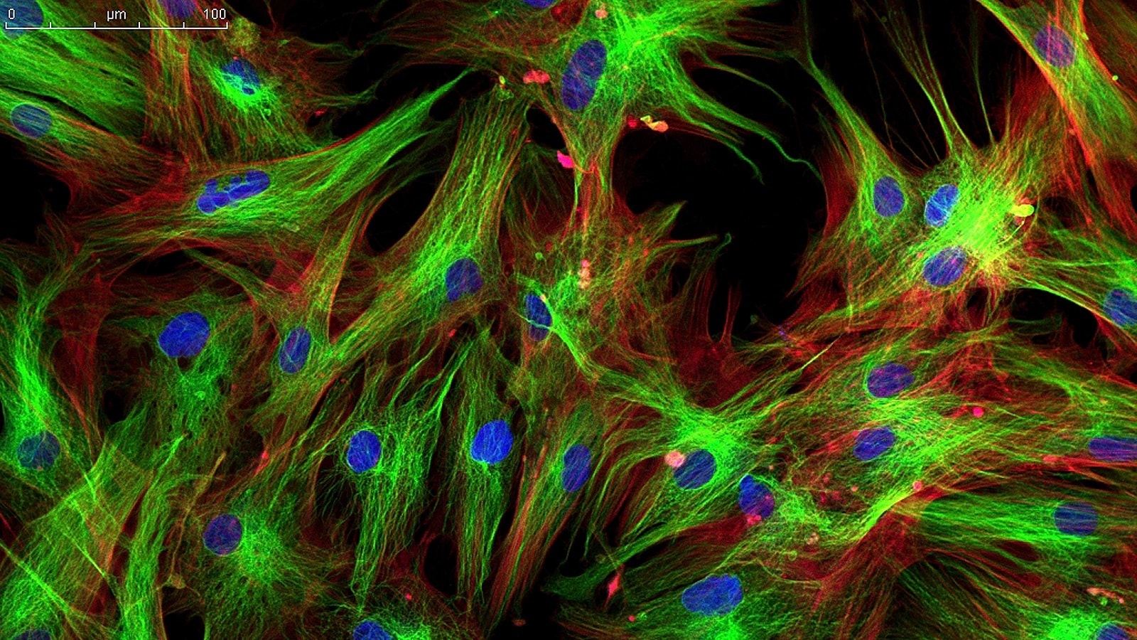 Komórki skóry oglądane pod mikroskopem fluorescencyjnym
