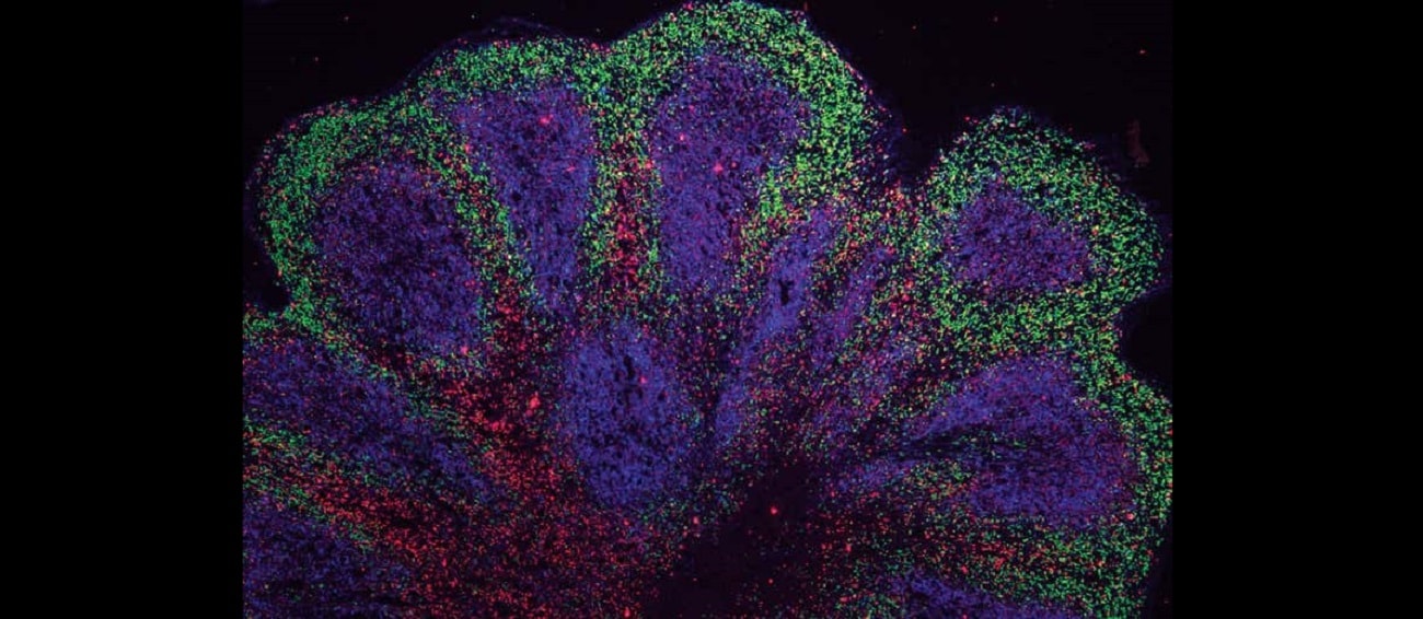 Wyhodowali mini-mózgi. Teraz chcą z ich wykorzystaniem leczyć śmiertelną chorobę