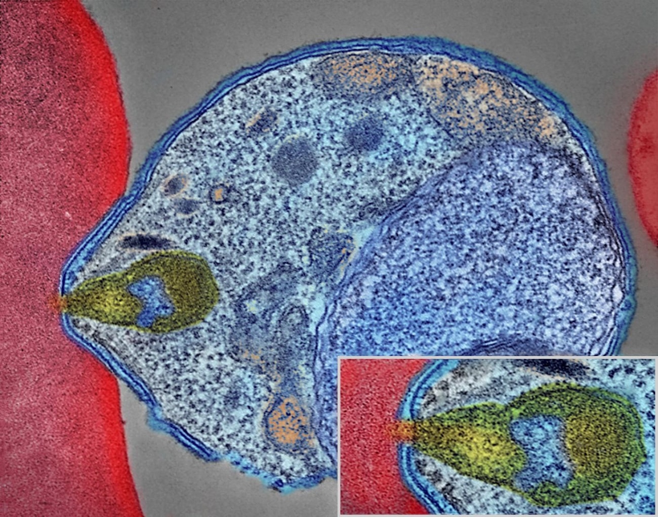 Tak malaria rozprzestrzeniła się po świecie. Związana z tym zagadka liczyła 100 lat