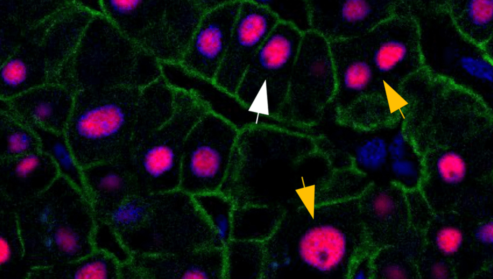 Wątroba ludzka składa się z komórek o różnej ilości DNA. Większość komórek ma tylko dwie kopie DNA, tak jak komórka oznaczona białą strzałką. Niektóre komórki gromadzą więcej zestawów DNA, jak te oznaczone żółtymi strzałkami. Te różne typy komórek odnawiają się w różny sposób
