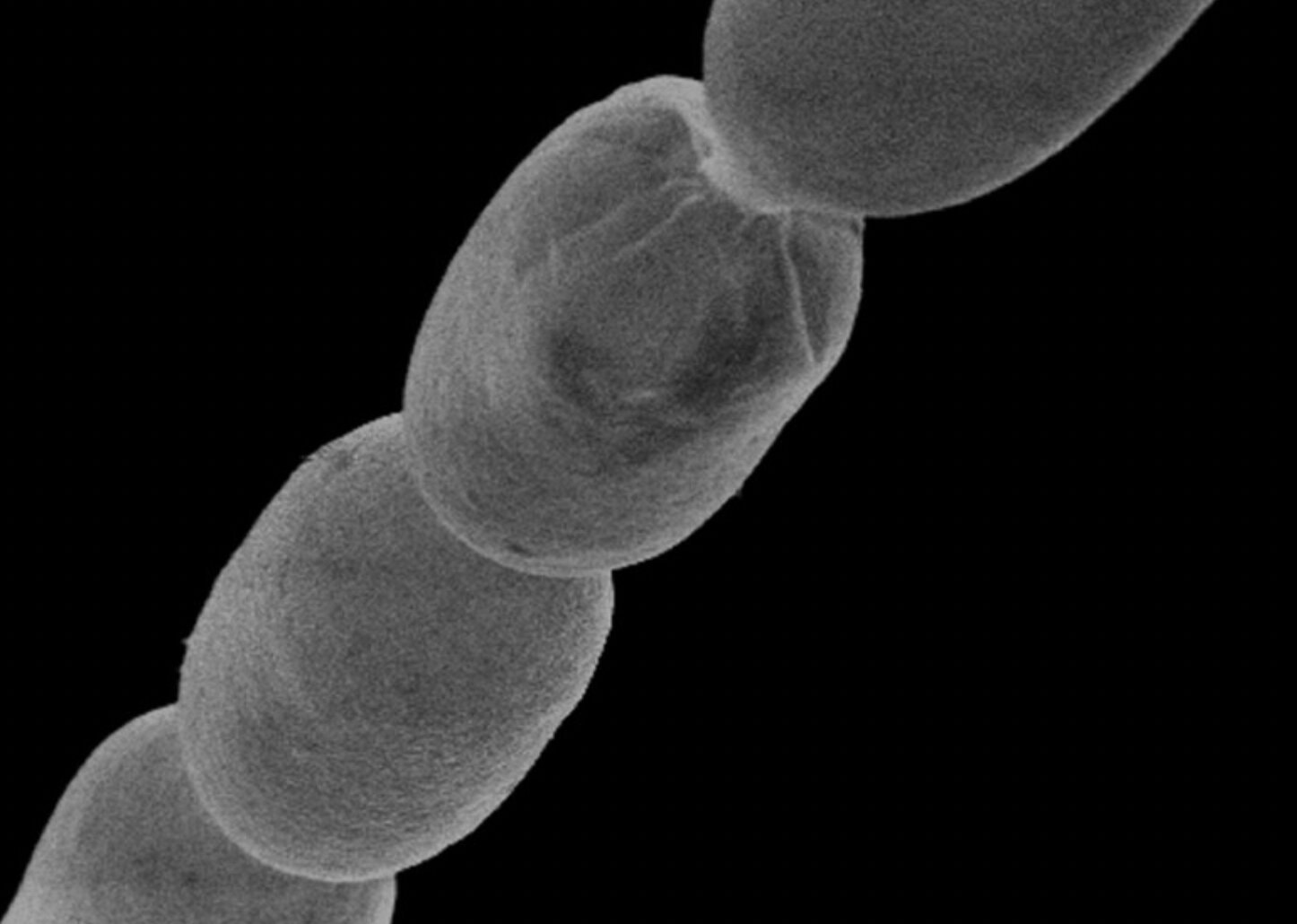 Thiomargarita magnifica
