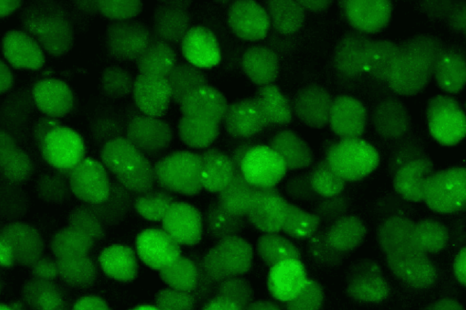 Modyfikując genetycznie mysz tak, aby produkowała mRNA znakowane zielonymi białkami fluorescencyjnymi (pokazane powyżej), badacze byli w stanie zobaczyć, kiedy i gdzie mózg myszy generuje Arc mRNA
