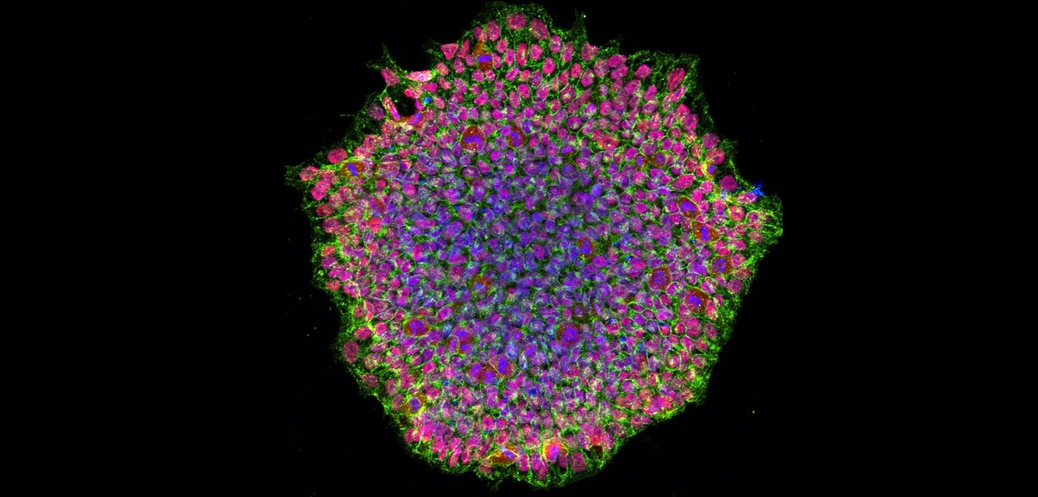 Jedna osoba, a komórki męskie i żeńskie. Niezwykły wyczyn naukowców