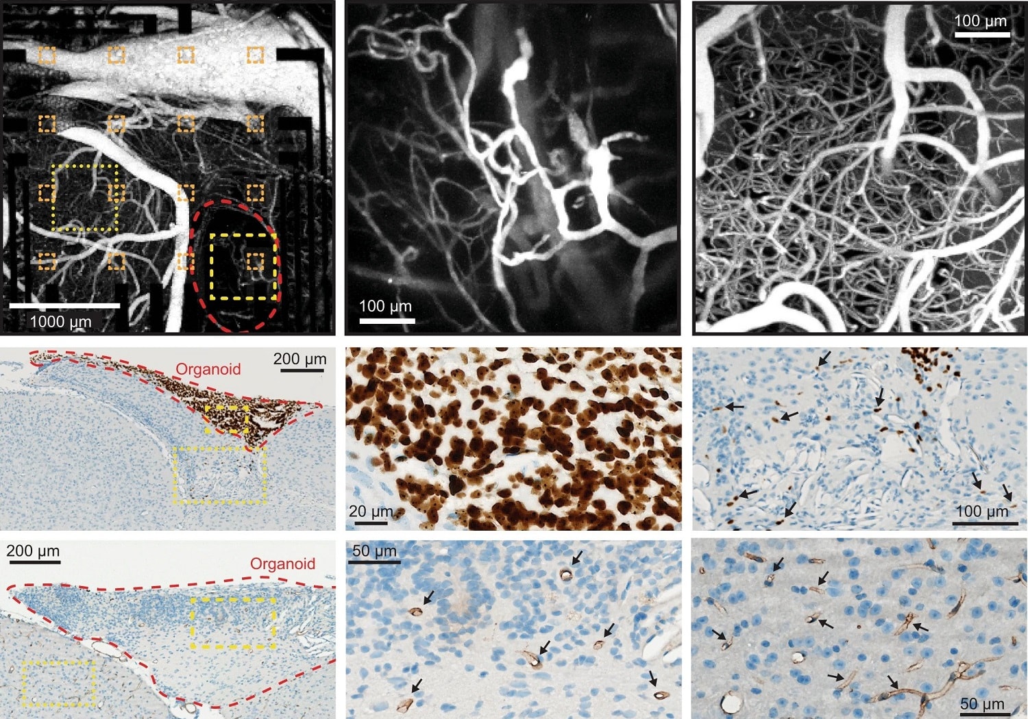 Stworzyli w laboratorium mózgi. Te zadziwiają swoją złożonością