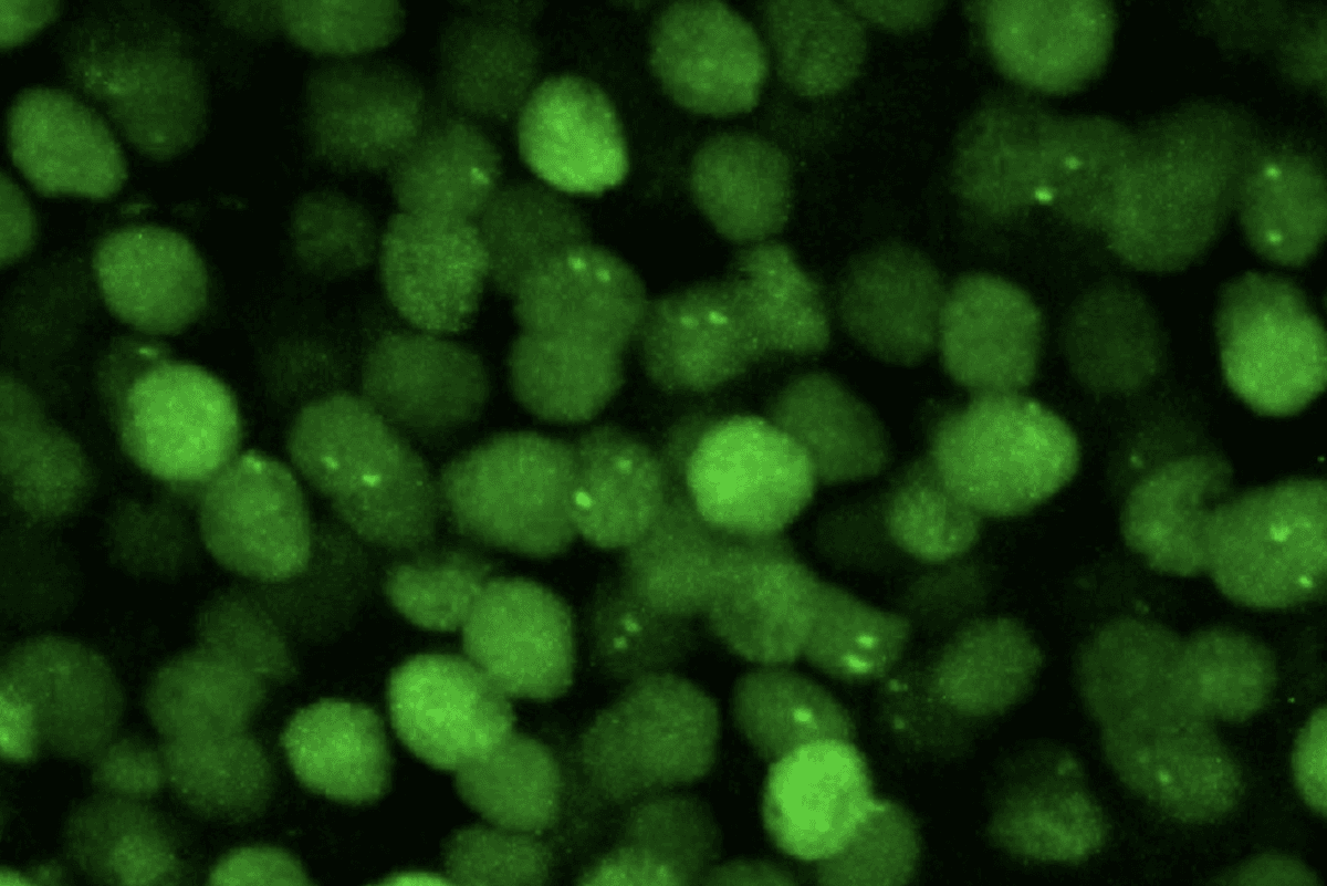 Modyfikując genetycznie mysz tak, aby produkowała mRNA znakowane zielonymi białkami fluorescencyjnymi (pokazane powyżej), badacze byli w stanie zobaczyć, kiedy i gdzie mózg myszy generuje Arc mRNA
