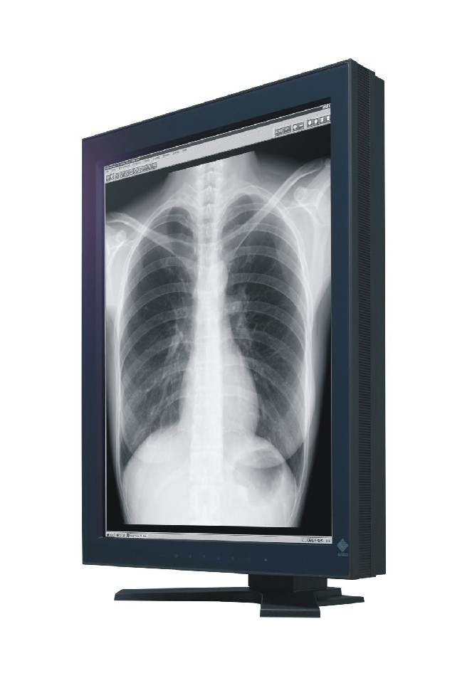3-megapikselowy, diagnostyczny monitor medyczny o naturalnej rozdzielczości 1 536 × 2 048