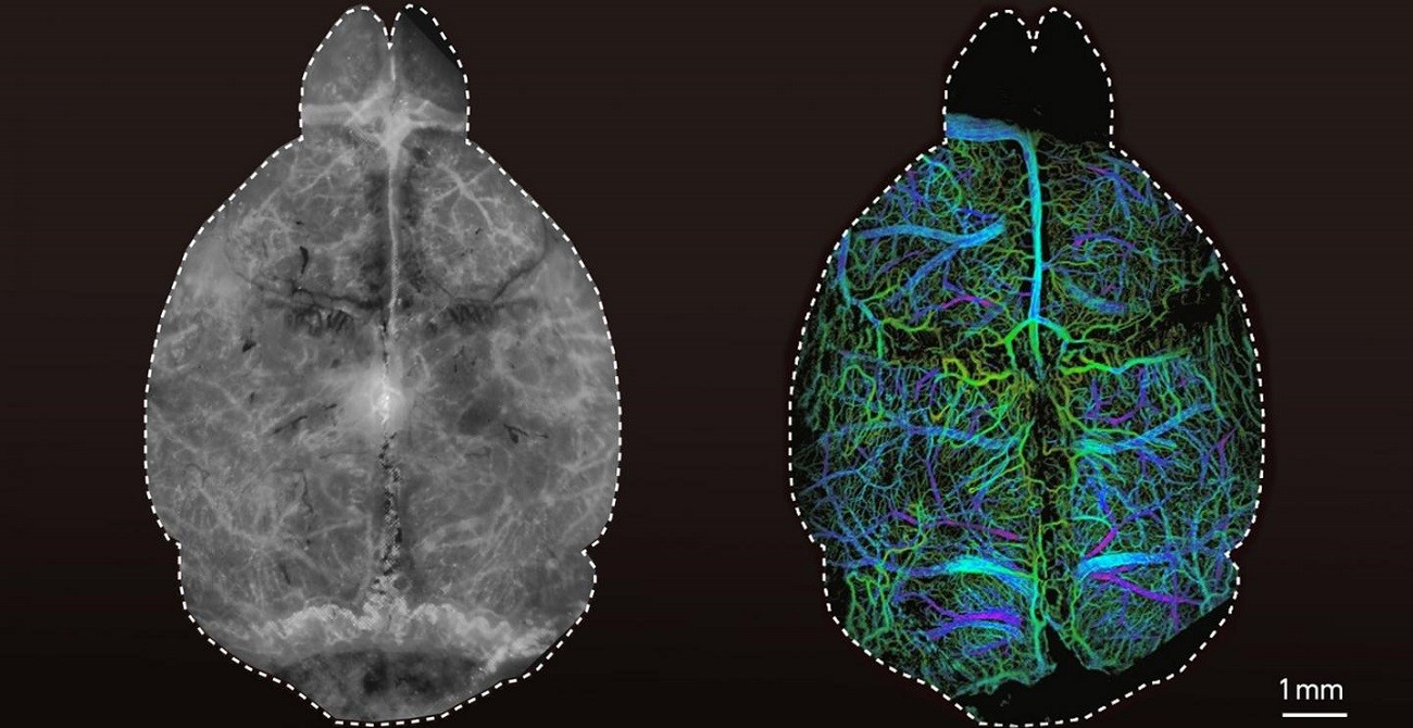 Jak zajrzeć do mózgu bez operacji? Nowa metoda dostarcza nowych sposobów