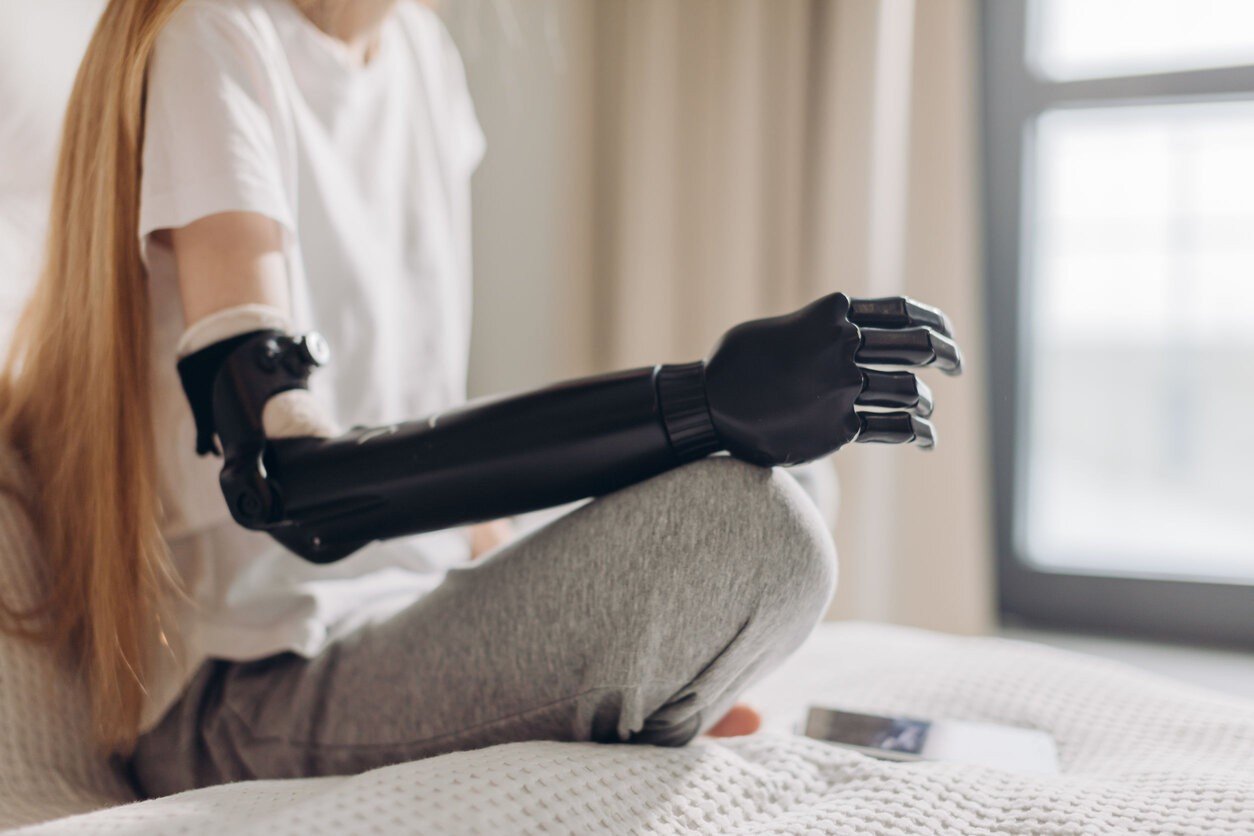 Bioniczne protezy będą jeszcze lepsze &#8211; to kwestia czasu
