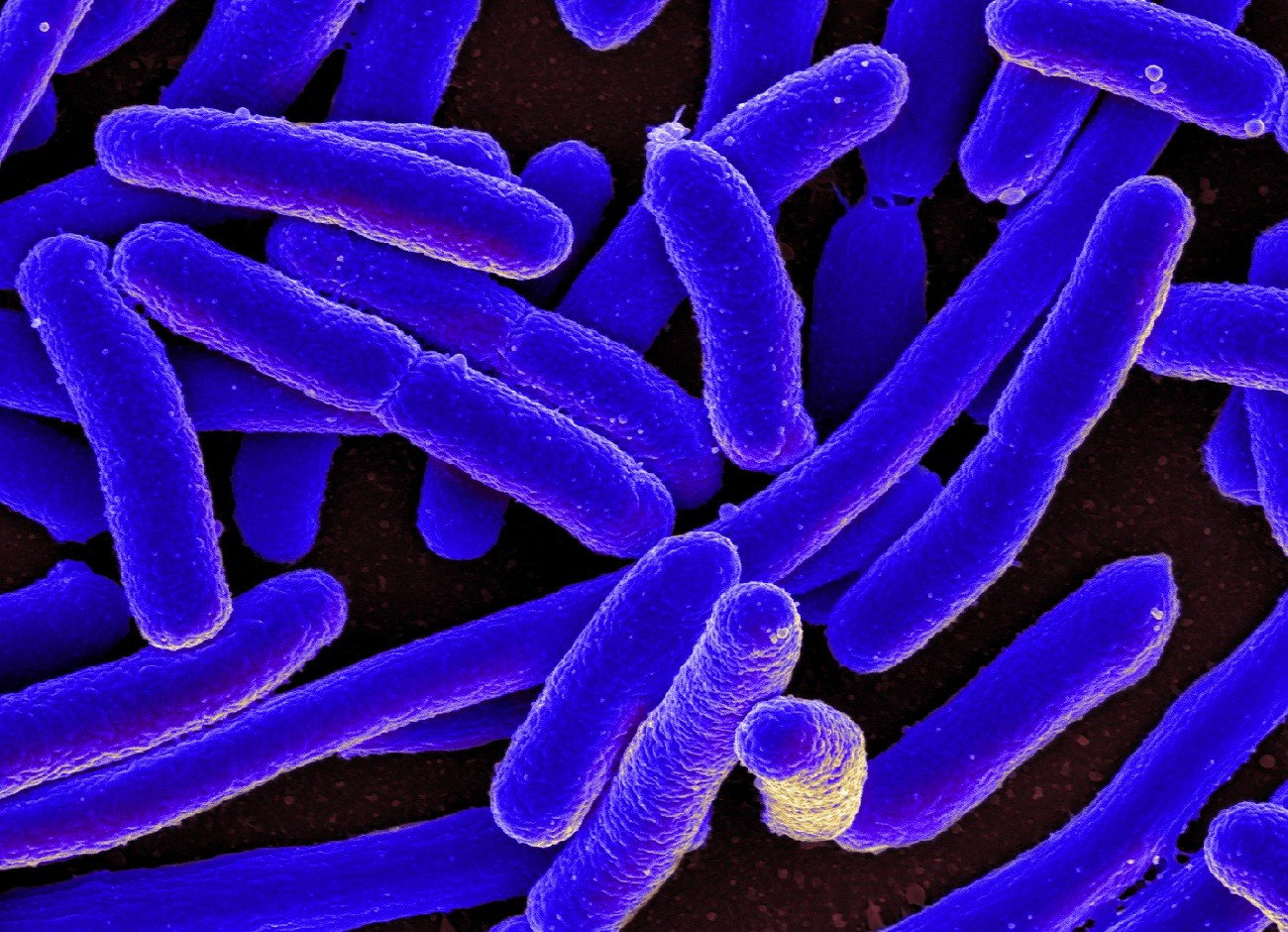 Żywa bakteria uwieczniona. Wykonano najostrzejsze zdjęcie w historii