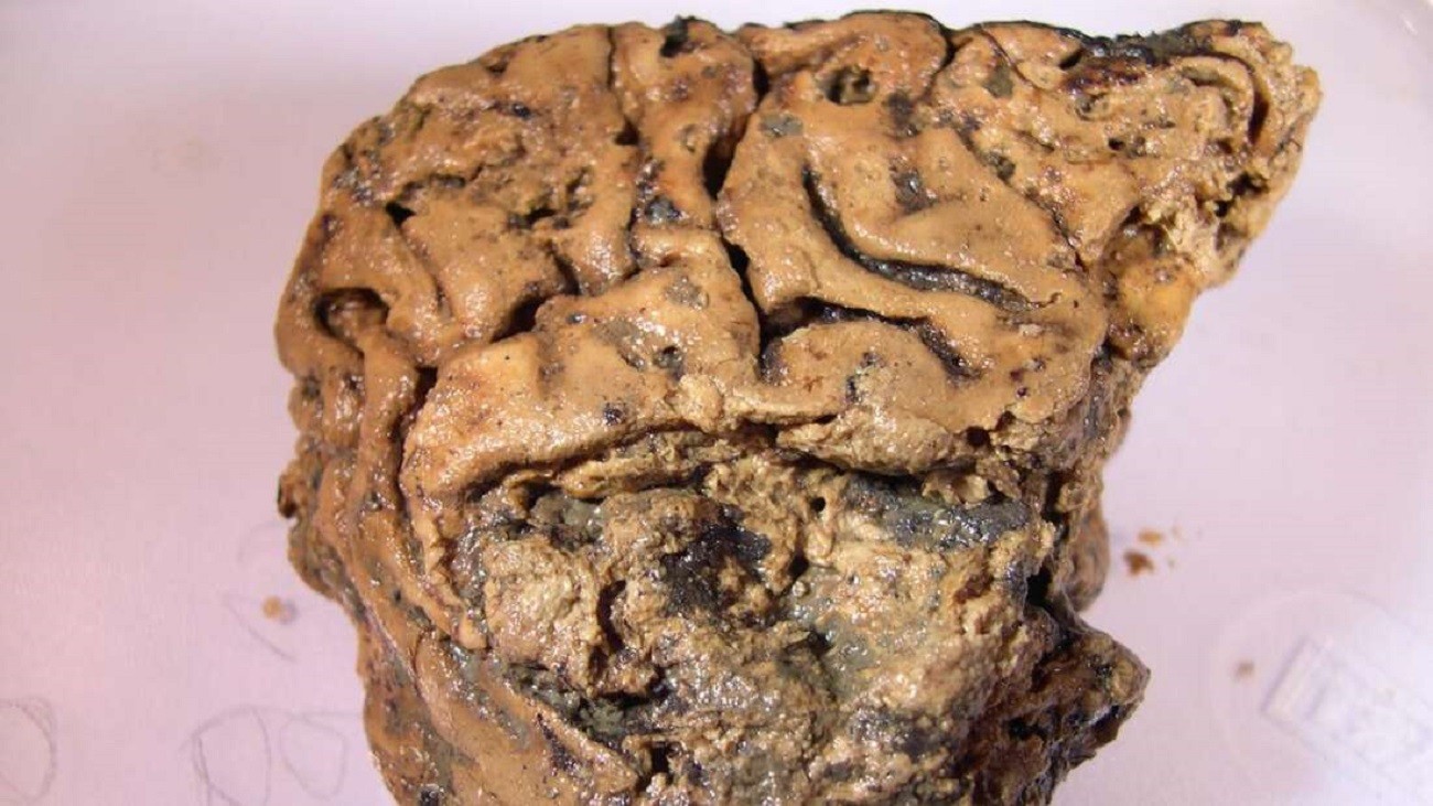 Czego możemy się dowiedzieć dzięki analizom mózgu sprzed 2600 lat?