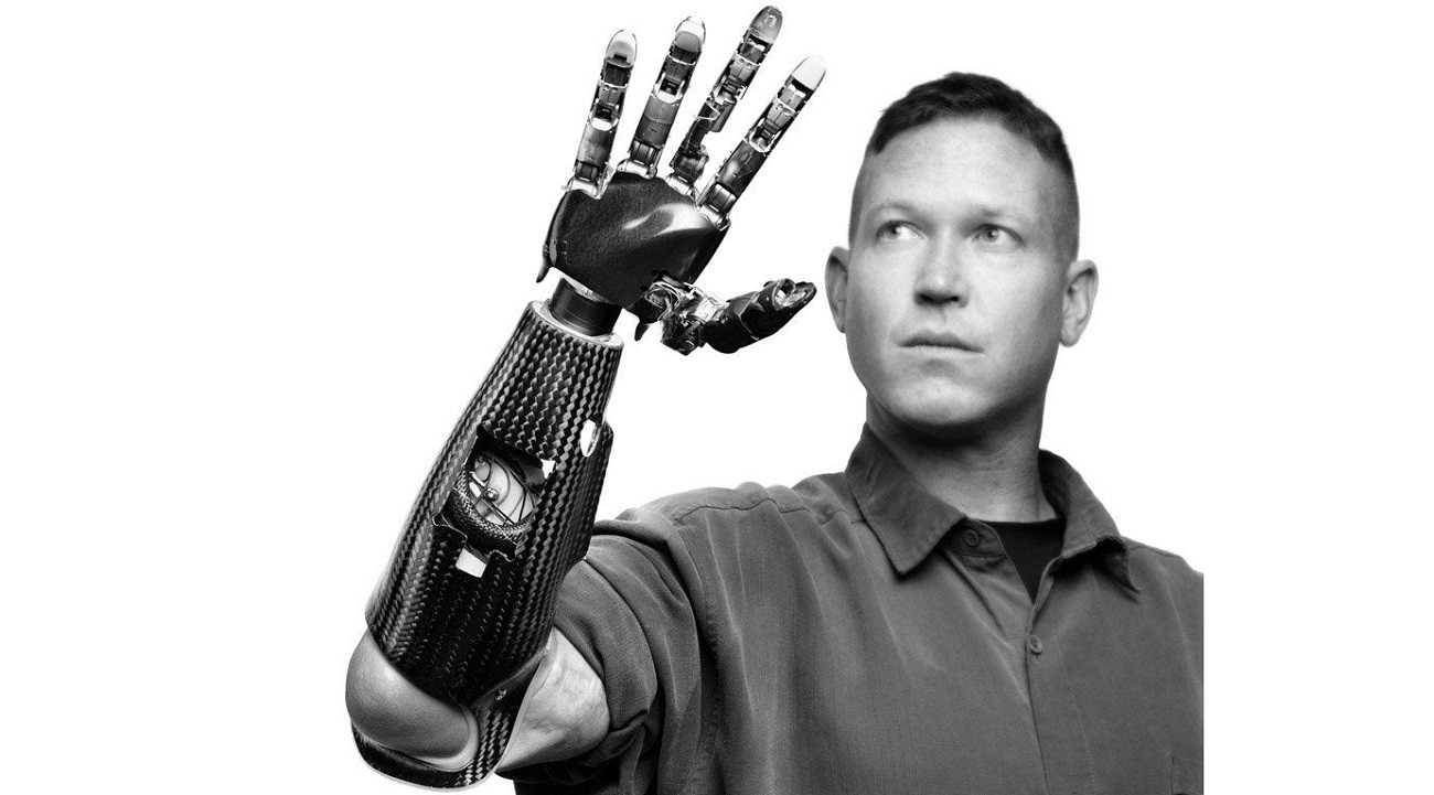 Bioniczne ramię niczym prawdziwa ręka. Jego możliwości są imponujące