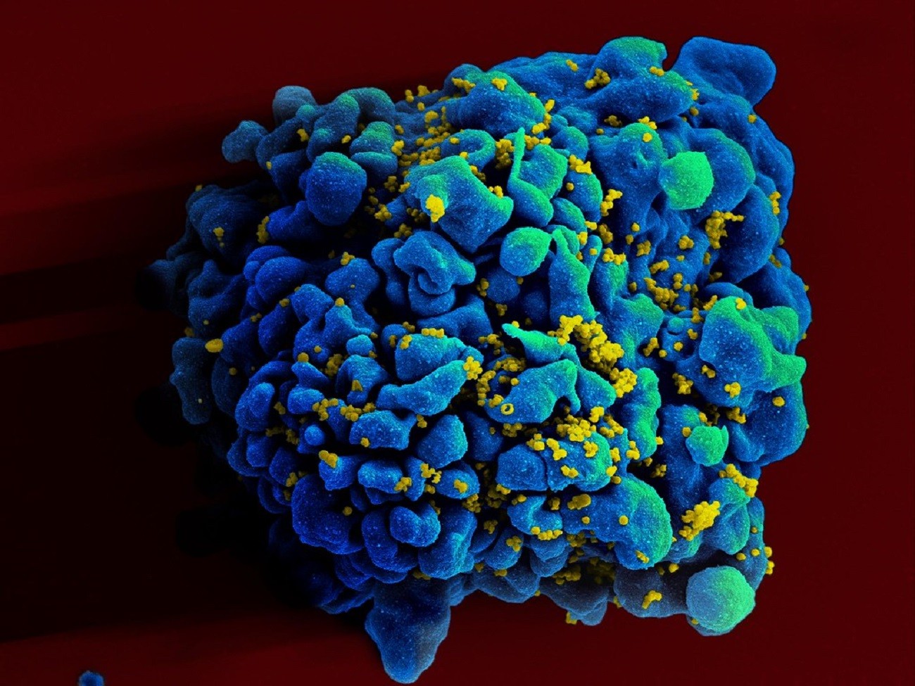 Dlaczego wirus HIV utrzymuje się w organizmie nawet po zakończeniu leczenia?