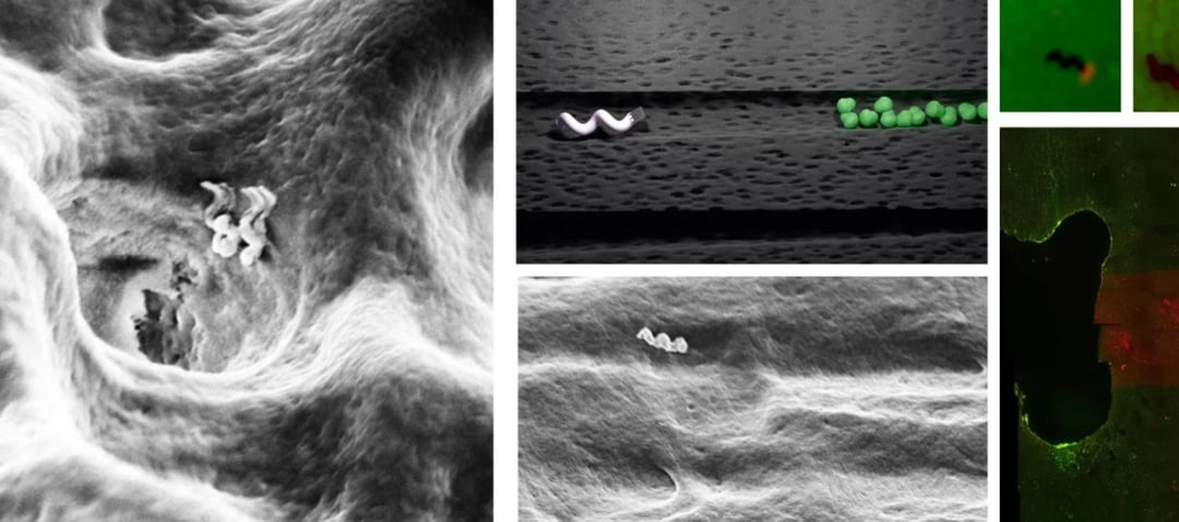 Alternatywa dla leczenia kanałowego zębów? Nanoboty niszczące zęby generowanym ciepłem