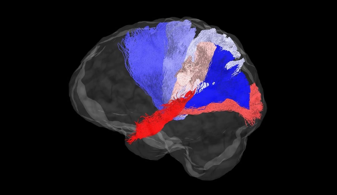 Procesory graficzne w służbie badań nad połączeniami w ludzkim mózgu