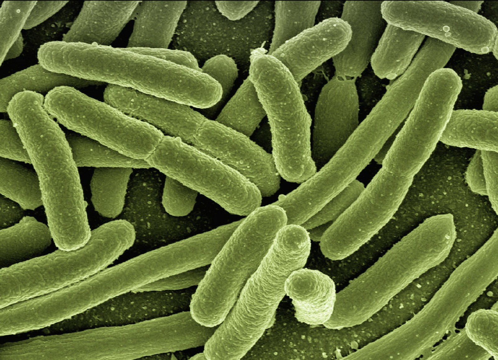 Bakteria Escherichia coli
