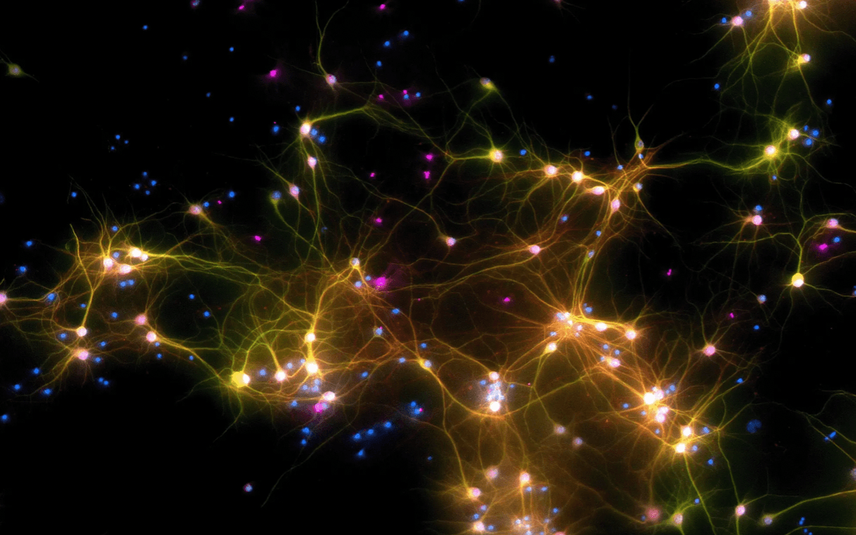 Neurony nauczono grać w Ponga /Fot. Cortical Labs

