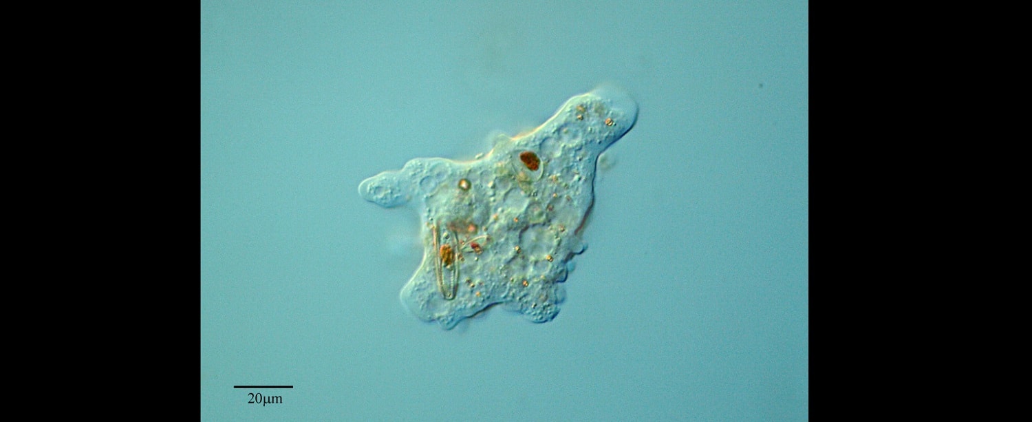 Ta ameba żywi się mózgami. Jest pierwsza ofiara śmiertelna