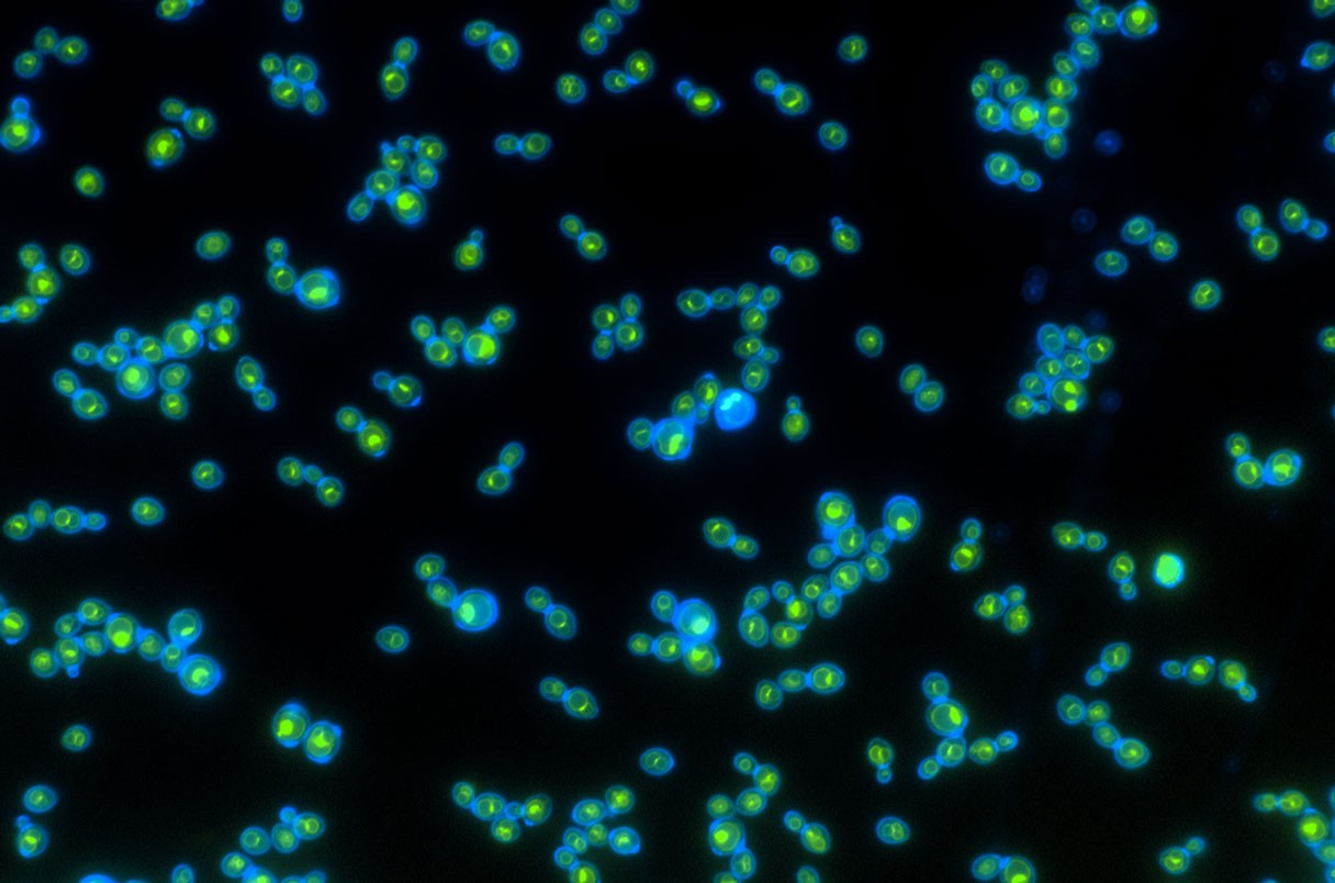 Niebieskie ściany komórkowe poszczególnych komórek drożdży otaczają rodopsynę (zieloną), która pomaga tym komórkom rosnąć szybciej /Fot. Science
