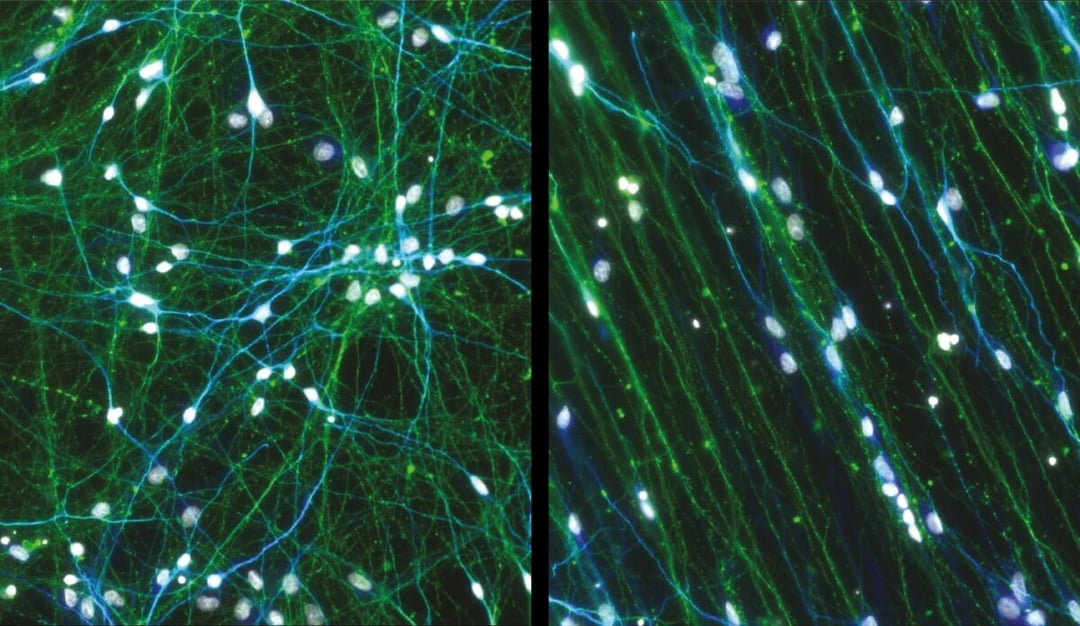 Bioinżynieria rodem z filmu. BioConNet naśladuje ludzki mózg